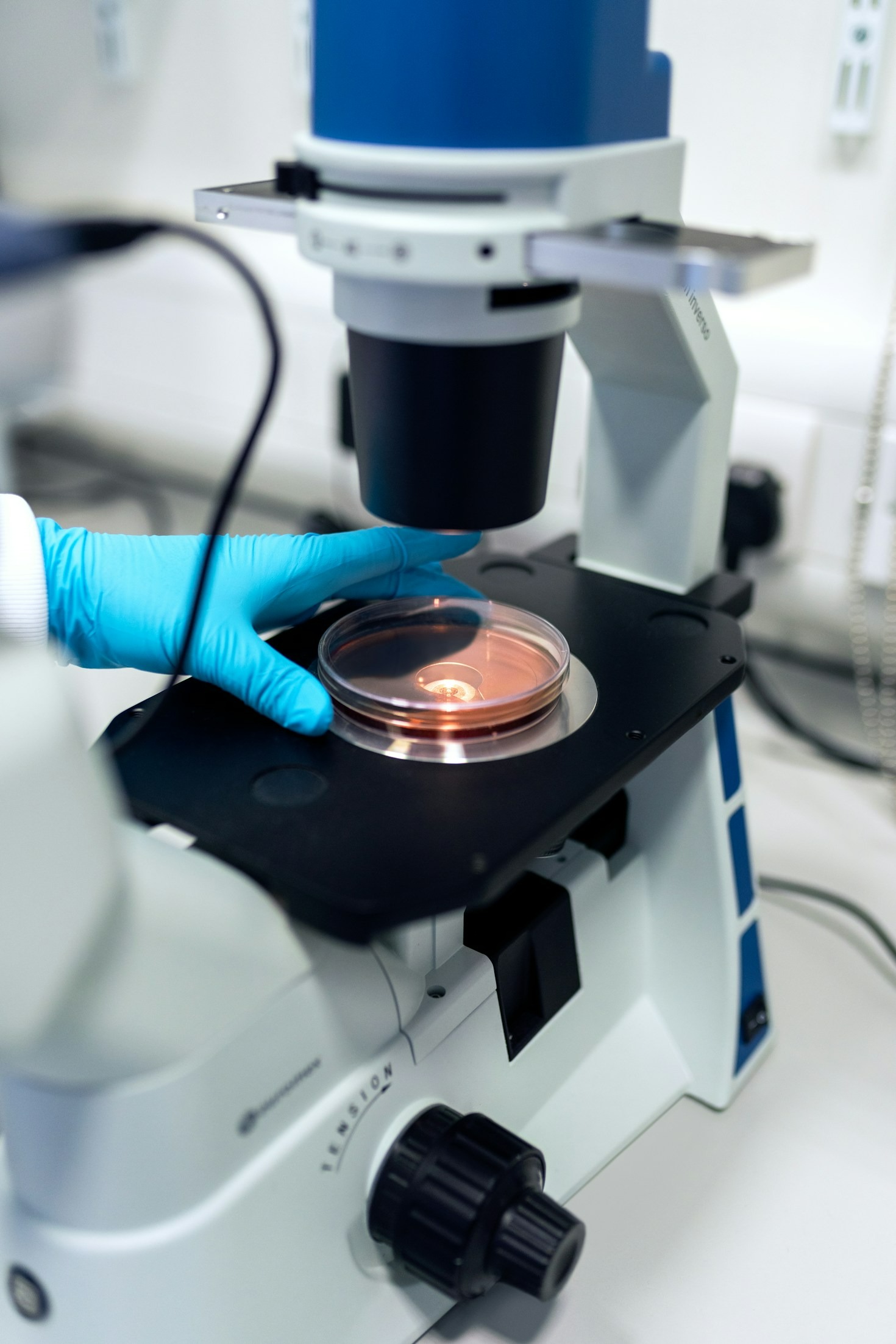 Choosing The Best Spores For Your Research