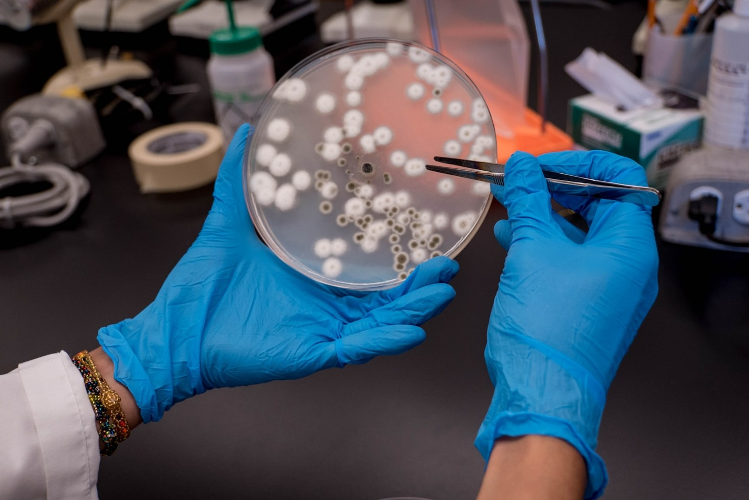 Common Challenges In Amateur Fungal Study
